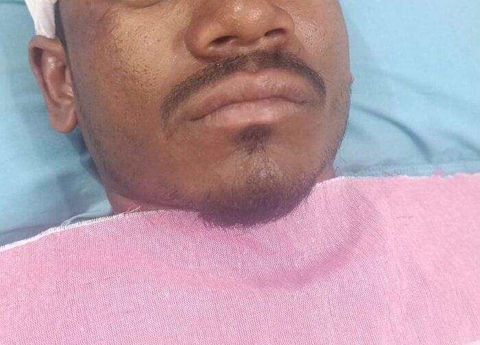 बिजली गिरने से युवक घायल, सेलूद अस्पताल में भर्ती