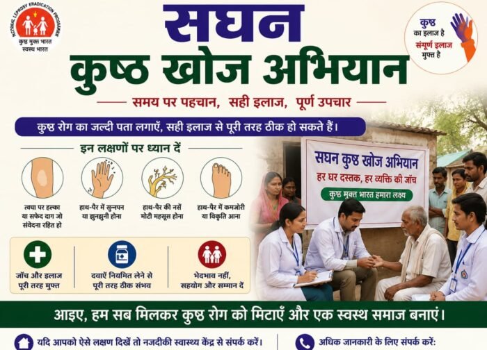 पाटन विकासखंड में 15 जून से 15 जुलाई तक चलेगा सघन कुष्ठ रोग खोजी अभियान